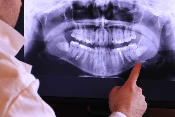 Best Emergency TMJ Treatment in Anna, TX
