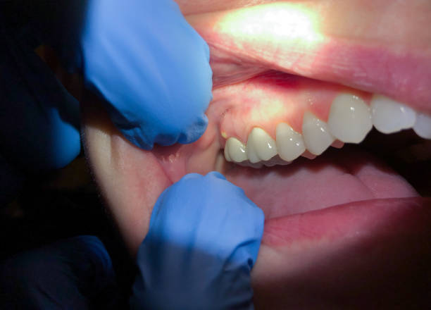 Best Weekend Emergency Dentist in Anna, TX