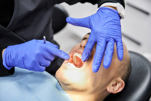 Best Emergency Wisdom Teeth Removal in Anna, TX