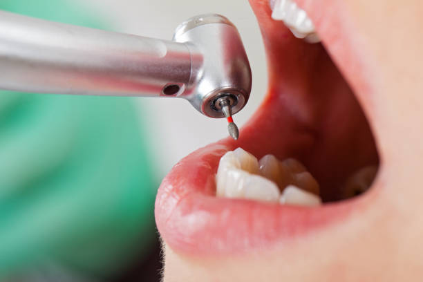 Best Urgent Care for Lost Fillings or Crowns in Anna, TX